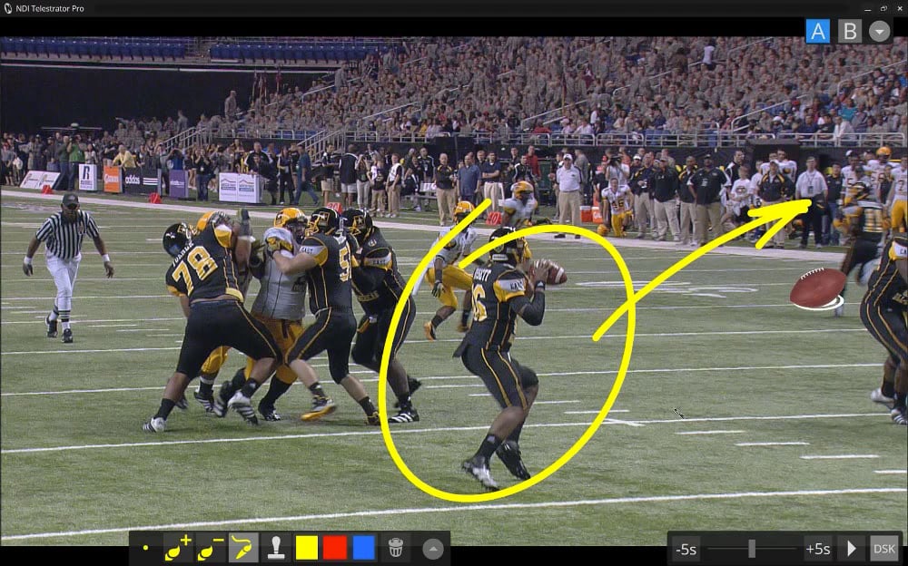 Telestrator 3Play® 3P1