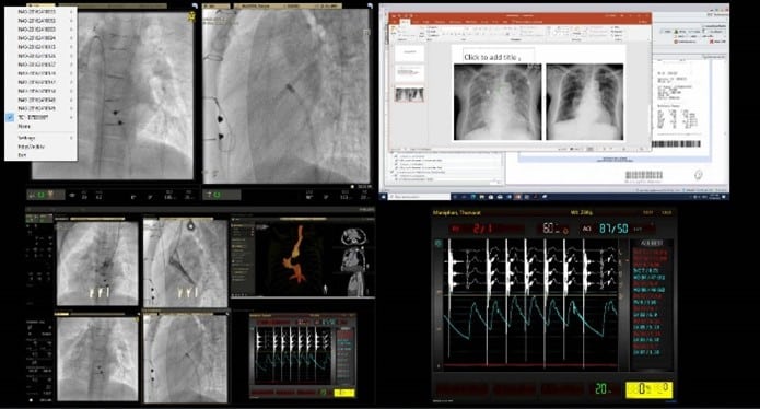 How Livestreaming is Transforming Cardiac Training and Consultations for a Major Thai Hospital